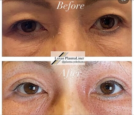 ✨ Luxus Plasma Liner — немецки