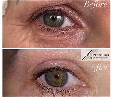 ✨ Luxus Plasma Liner — немецки